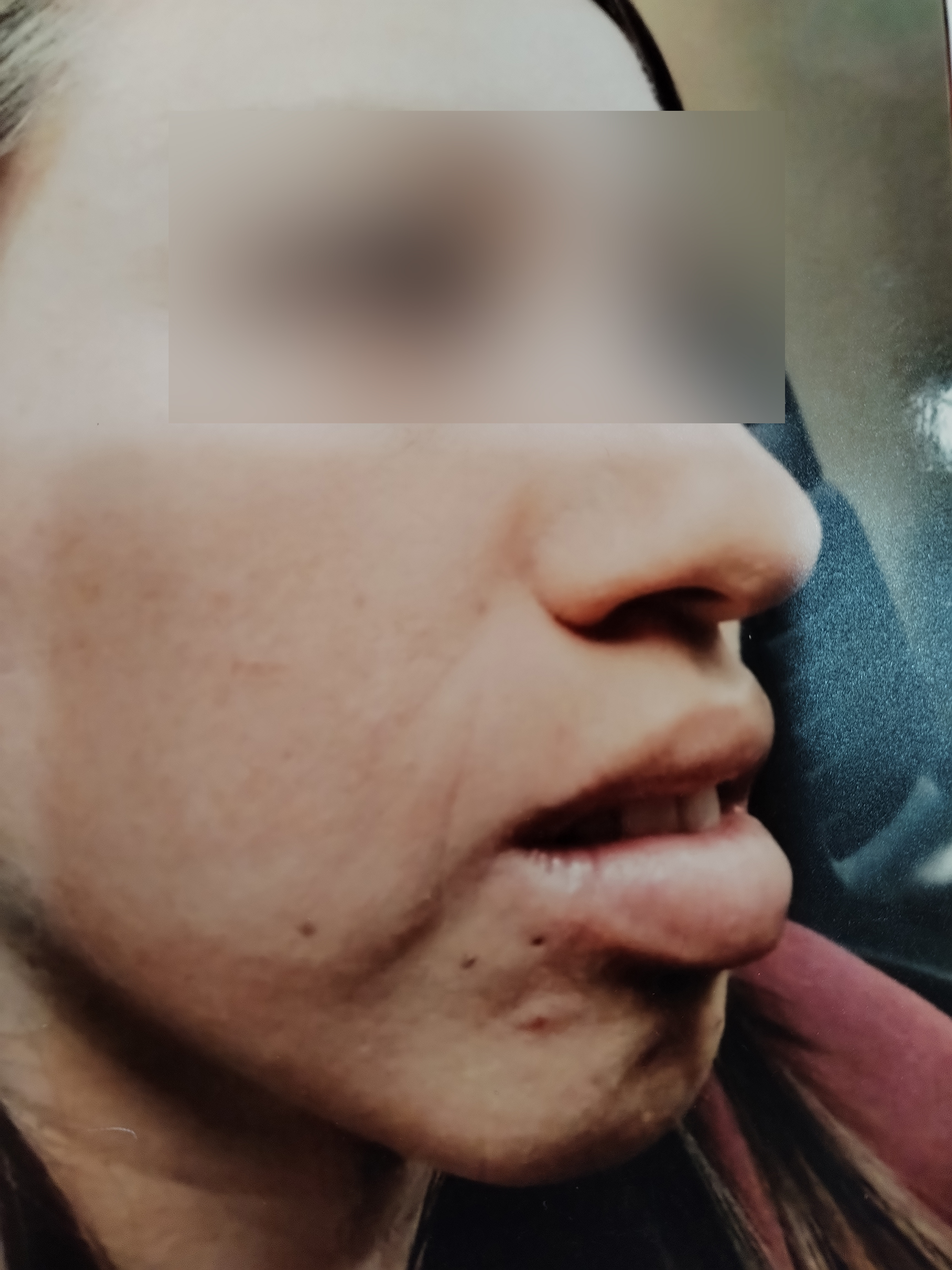 Caso 6 antes