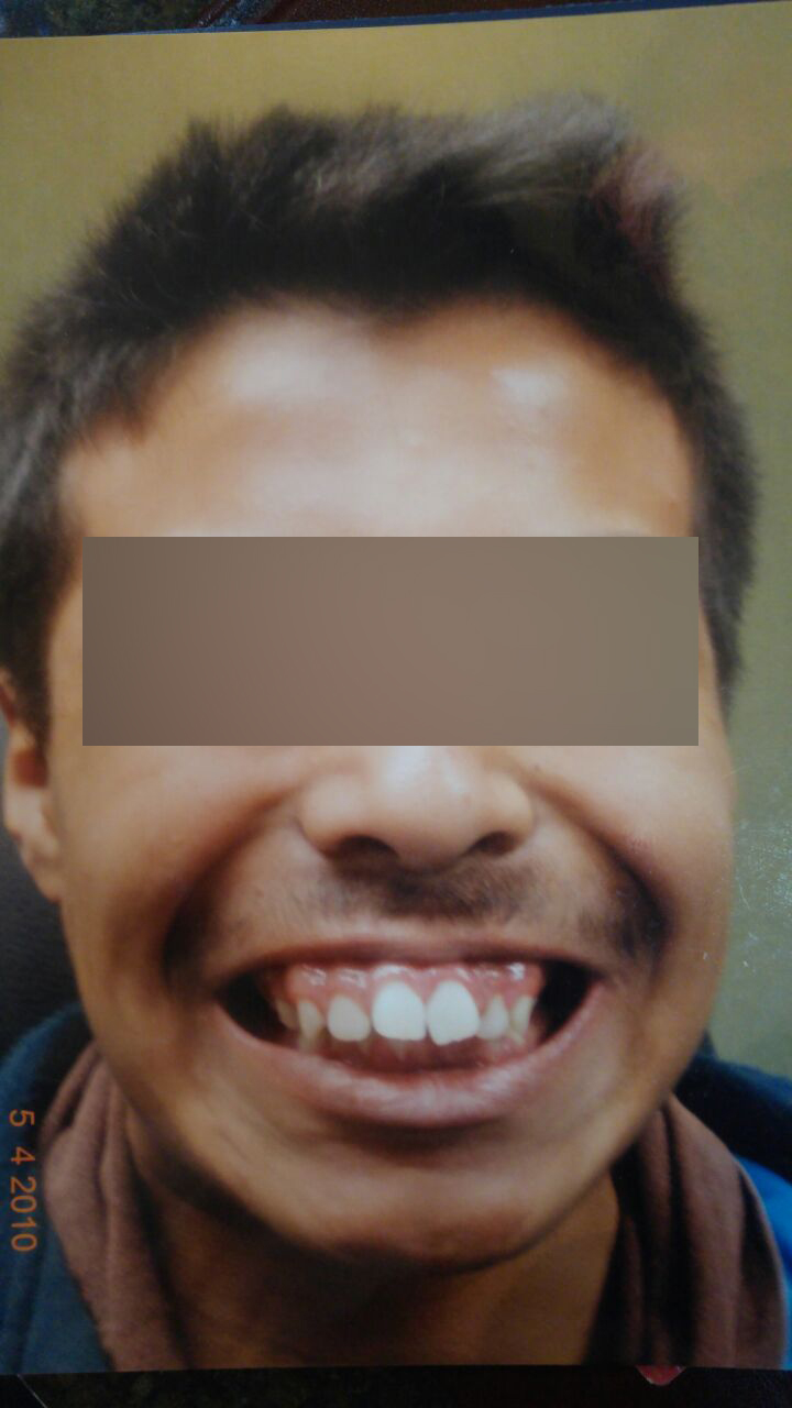 Caso 7 antes