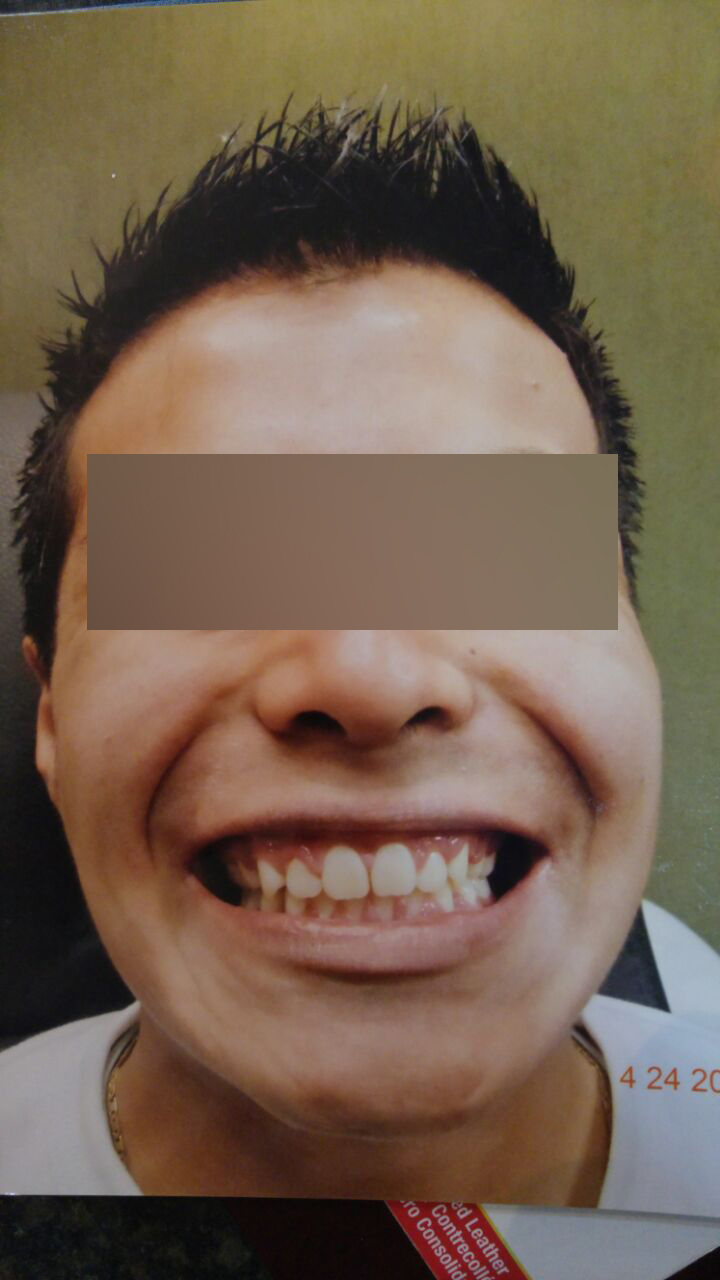 Caso 7 despues